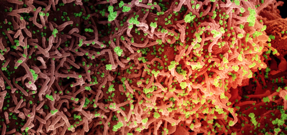 Micrografía electrónica de barrido coloreada de una célula infectada con una cepa variante del virus SARS-CoV-2 (21 de diciembre de 2021). NIAID / Flickr, CC BY-SA