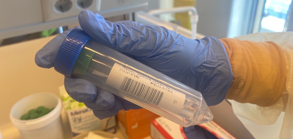 Muestra de SARS-CoV-2. ACFI PRESS