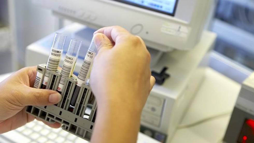 Muestras de sangre. Imagen de archivo