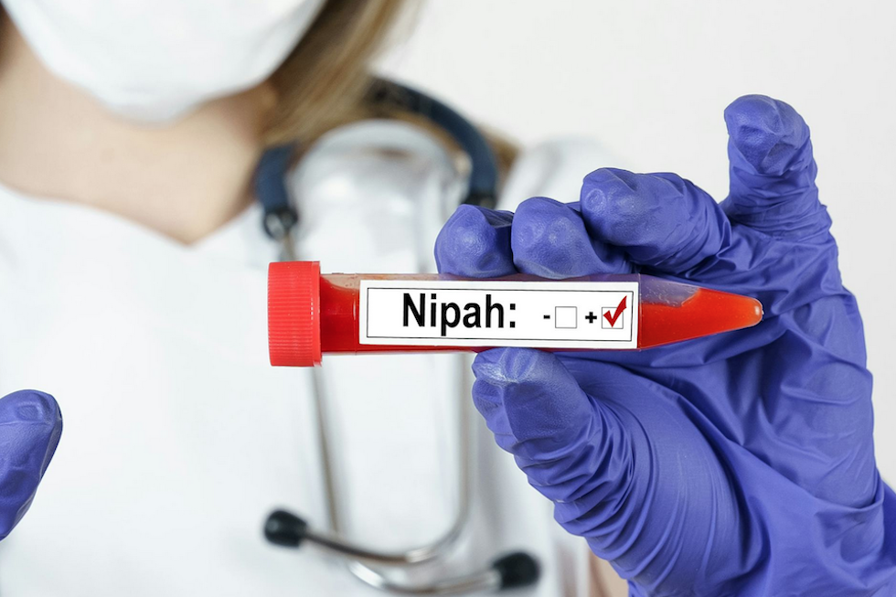 Claves que debemos conocer sobre el peligroso virus Nipah