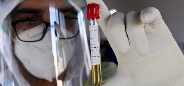 Muestra para analizar la Covid 19. EFE