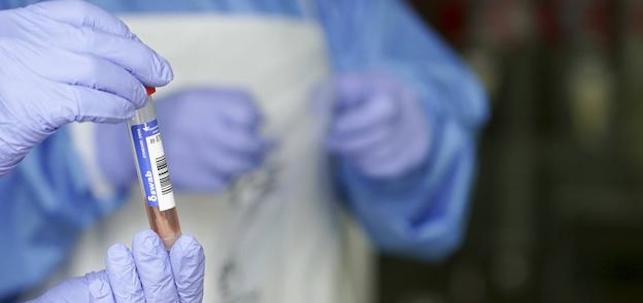 Pruebas COVID-19. EFE