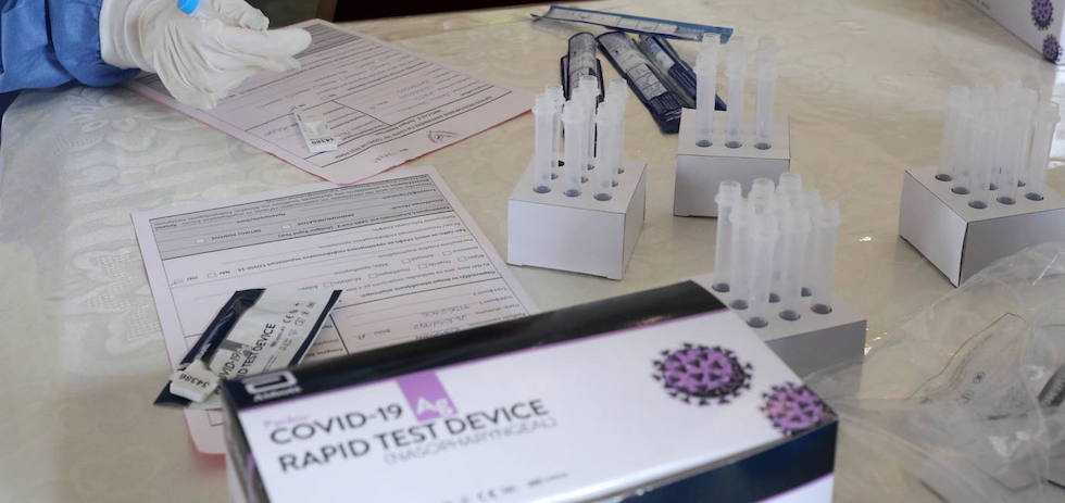 Test rapido, covid 19. EFE