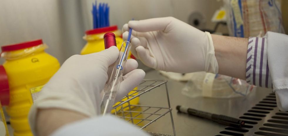 Muestras de la viruela del mono.