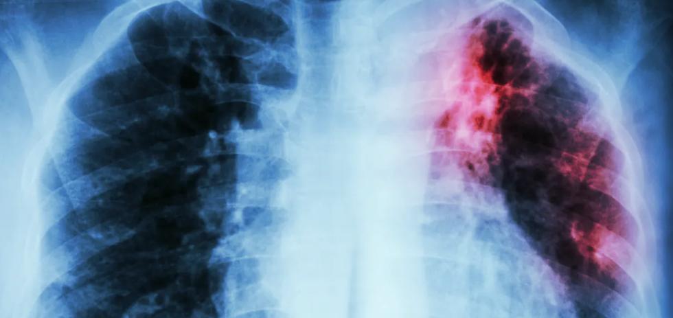 Shutterstock / Puwadol Jaturawutthichai