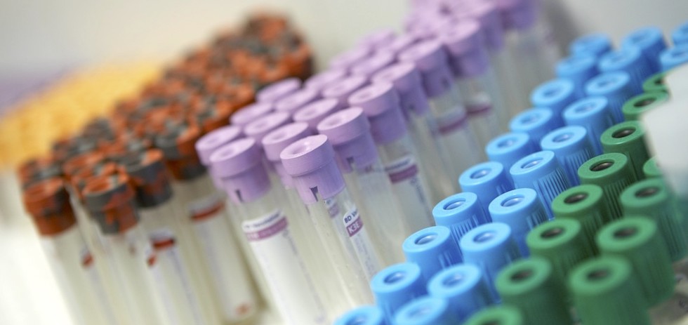 Tubos de muestras de sangre.