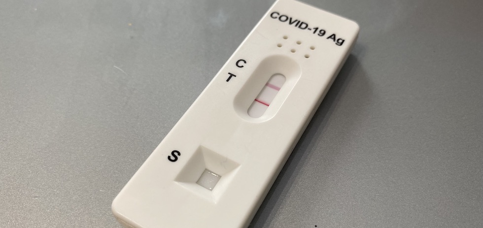 Test de antígeno positivo en Covid-19