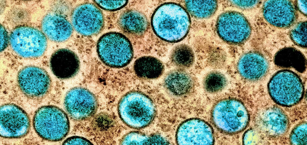 Imagen coloreada de part&iacute;culas de viruela del mono en una c&eacute;lula infectada (marr&oacute;n), cultivada en el laboratorio.Cr&eacute;dito: NIAID. Flikr NIAID , CC BY-SA