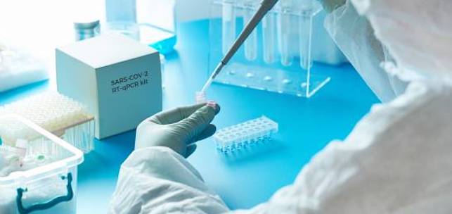 Elaboraci&oacute;n de las PCR.