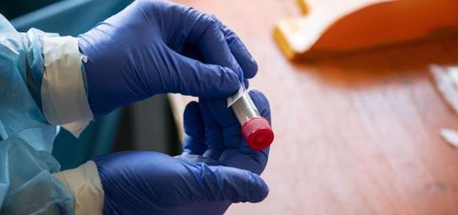 Pruebas diagn&oacute;sticas. EFE