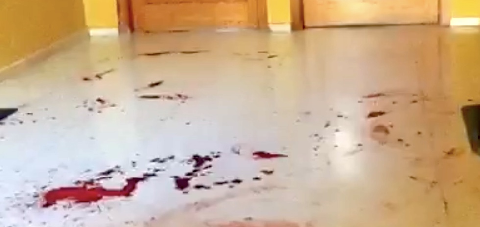 Rastro de lo sucedido en el portal del afectado. MASPALOMAS AHORA