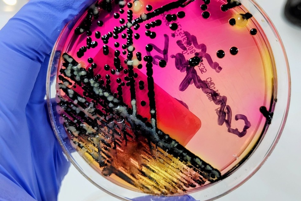 Cultivo de Salmonella