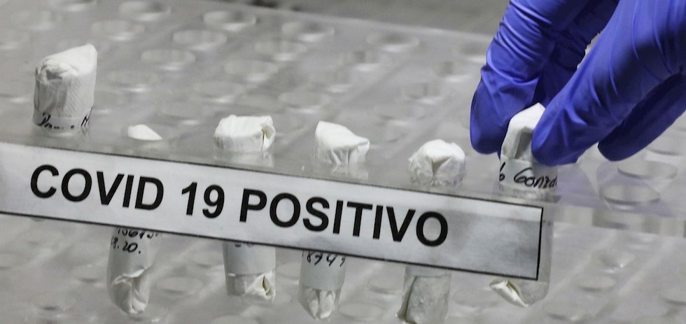 Test PCR Covid19