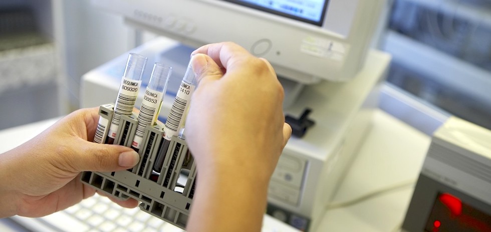 Muestras de sangre en el laboratorio.