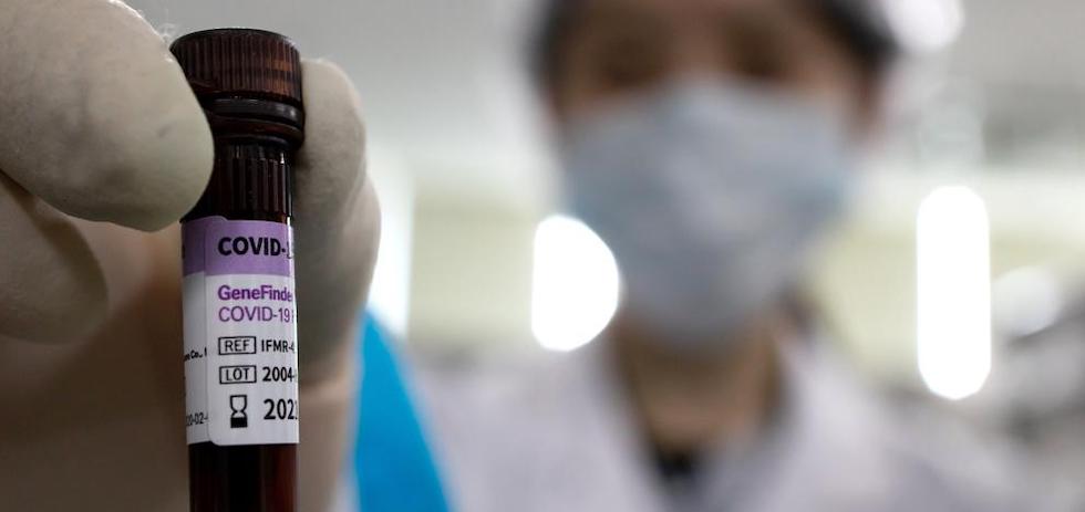 COVID 19 PCR. MASPALOMAS AHORA