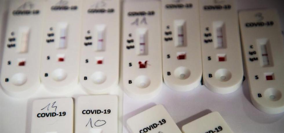 Test de antígenos. EFE