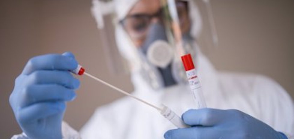 PCR, COVID19. MASPALOMAS AHORA