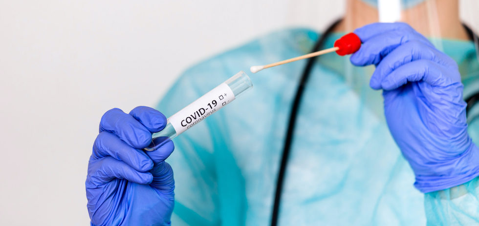 Prueba PCR COVID 19.