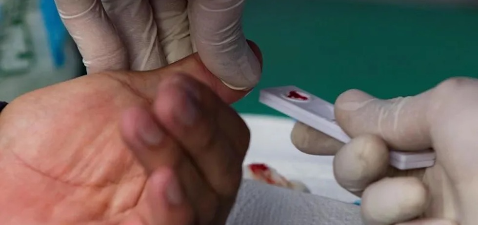 Test de antígenos | EFE