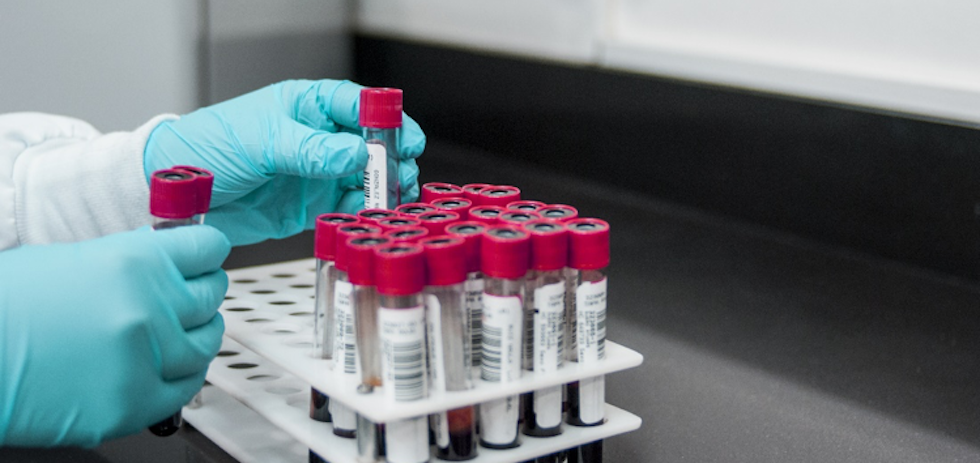 Prueba diagnóstica.